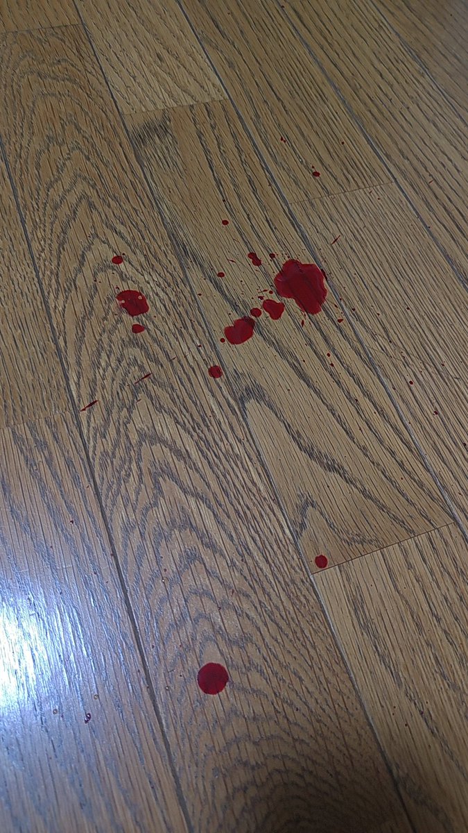 ken85_P's tweet photo. これでも拭いたんだが殺人事件かよってぐらい鼻血が出たわ😅 https://t.co/7aVP9Mdm2t