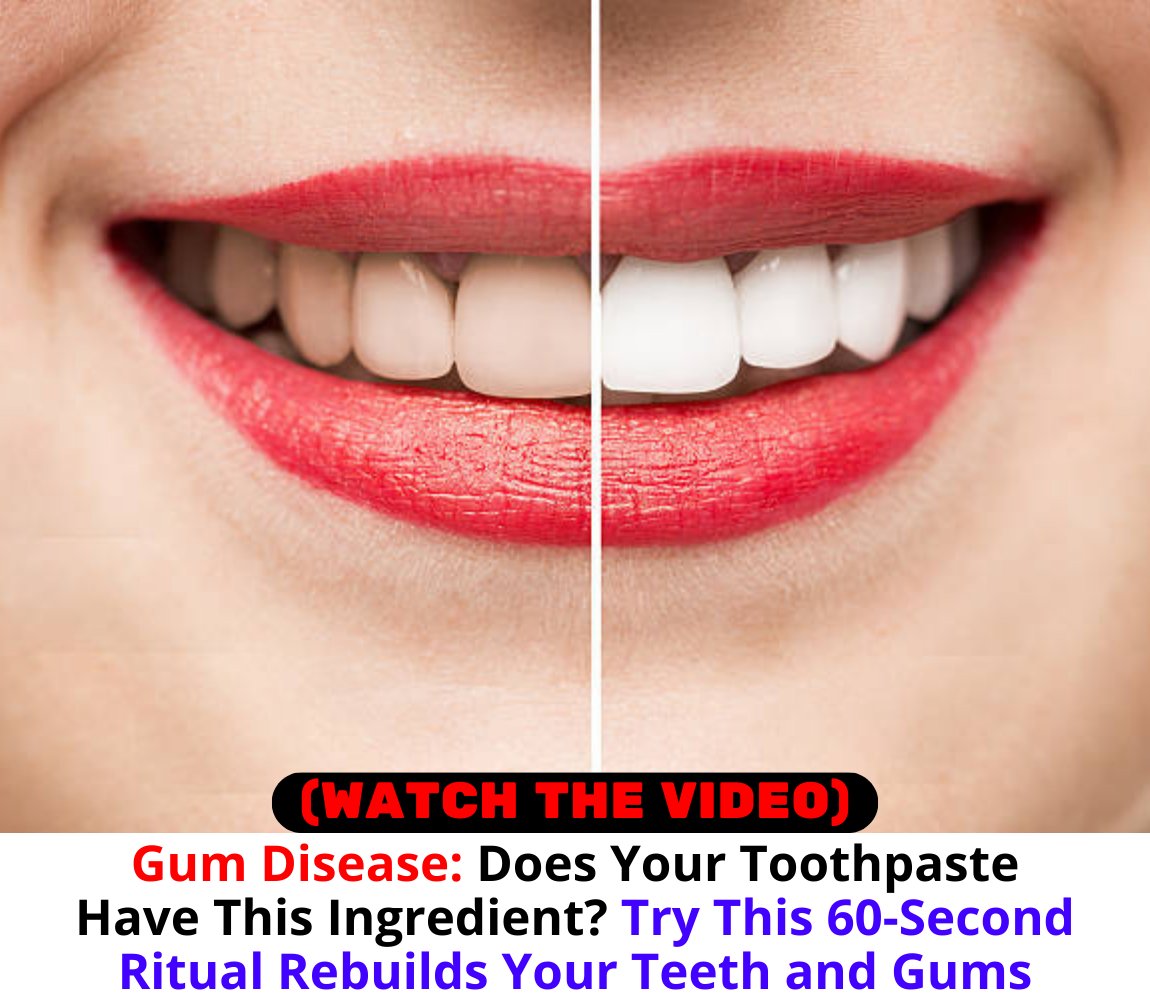 WinJose8's tweet image. #dental #dentalcare #teethgoals #prodentimprobiotic
#teeth #smiles #prodentim #whiteteeth #healthcare  
#OralCare #tooth #decay #viral #DentalHealth
With this cutting-edge oral care product, 
safeguard your teeth and gums. 
👉 f.mtr.cool/asftmpdmwd 👈