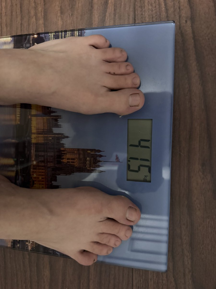 bulimic4ever's tweet image. 28/04/26 #bodycheck #edtwt #edtwtㅤ #fatgirl #huge #cow #pig #legs #fatt #piggy #ana #mia #anatwt #miatwt #wideribcage #fat #stomach #ricecake #ribcage #ricecaketwt #muffintop #shortgirl #weighin #meanspo #edtwtᅠ #fatspo #kg #bmi #thinspo