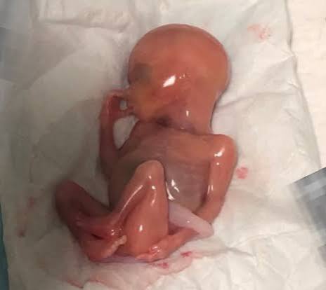 Sunshine Diamond Eyes tweet media