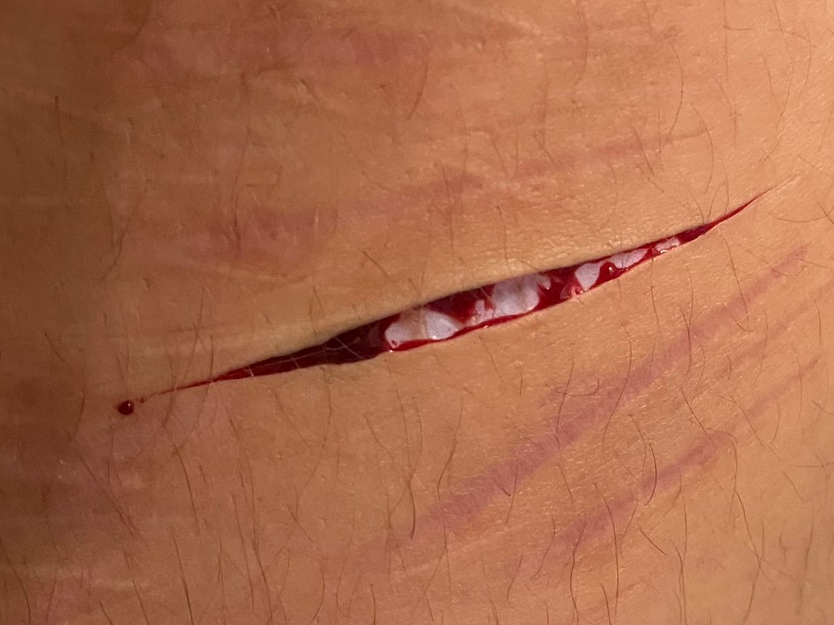 。★ Ace of shedtwt ☆。 tweet media