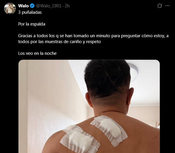 Ricardo Canchanya N🅤ñez tweet media