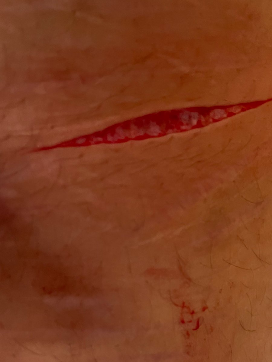 。★ Ace of shedtwt ☆。 tweet media