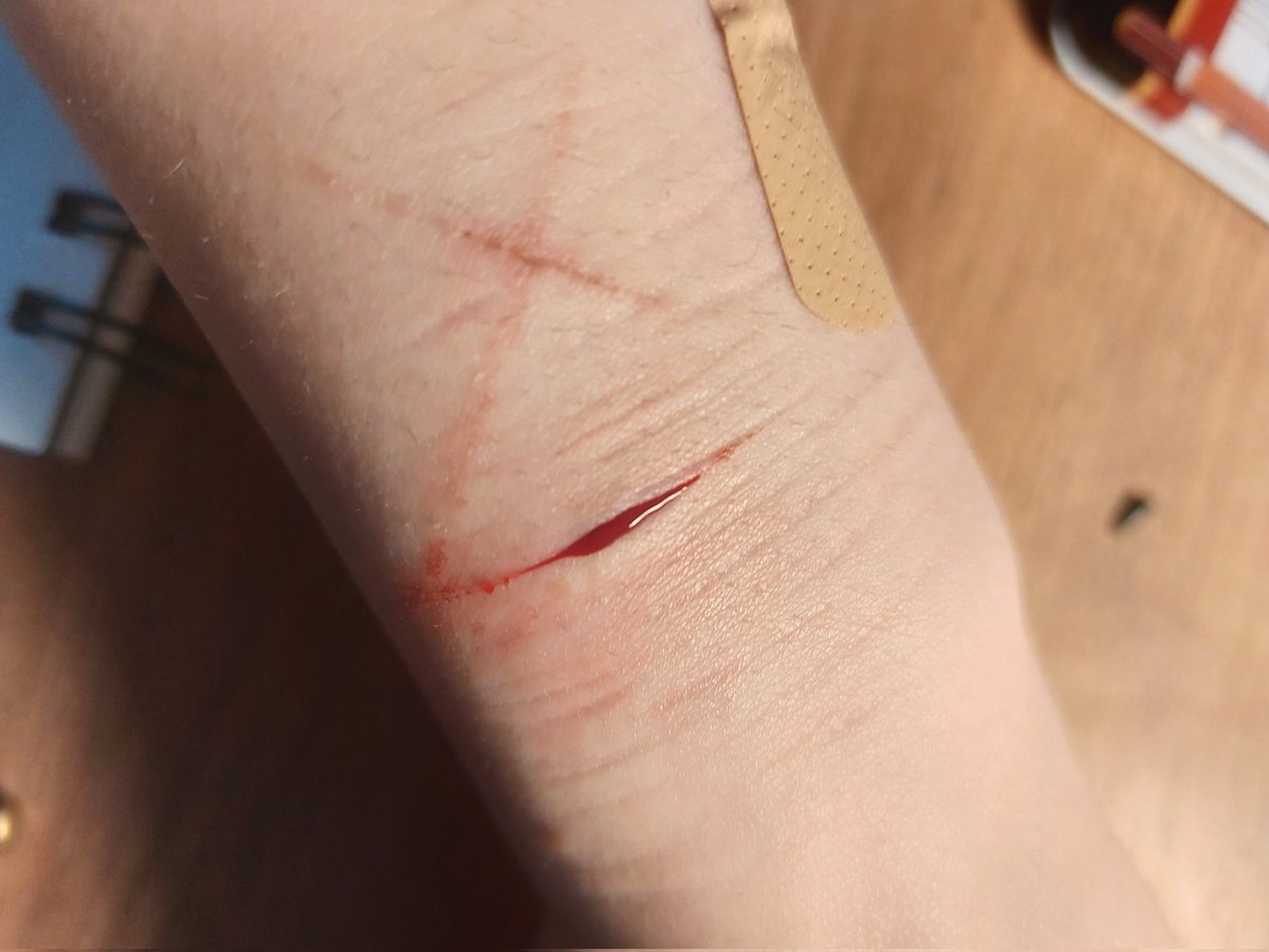 DominikaDrabek's tweet photo. Deepest I've gone so far, couldn't stop bleeding lmao #shtwt #styro #deepstyro https://t.co/mOvGXOT6Xu