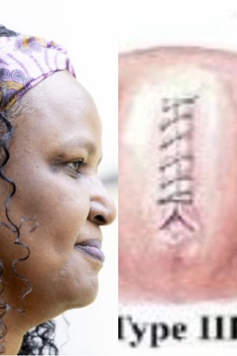 thegirdlengr's tweet image. My #FGM Torture💔
"Some 'Infibulated Girls'  Committed Suicide On Their Wedding Night Because They Were Scared To Face The Pain Of Being Penetrated By Their Husbands!"

Asha Ismail Recounts:
"I was five years old when my mother took me to Moyale, a small town in Kenya, where my