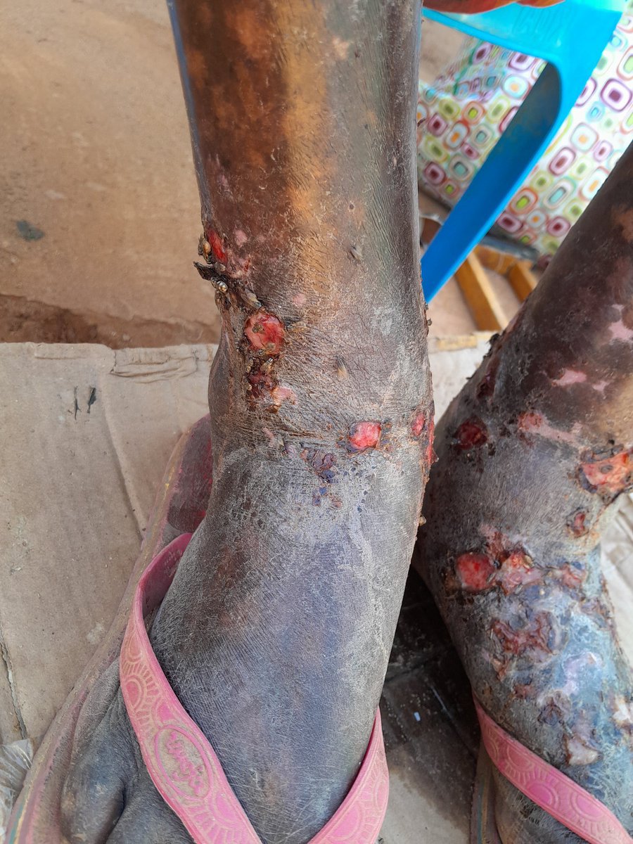 hemo_shk's tweet photo. What is the diagnosis or differential diagnosis? https://t.co/SxYuSEsNub