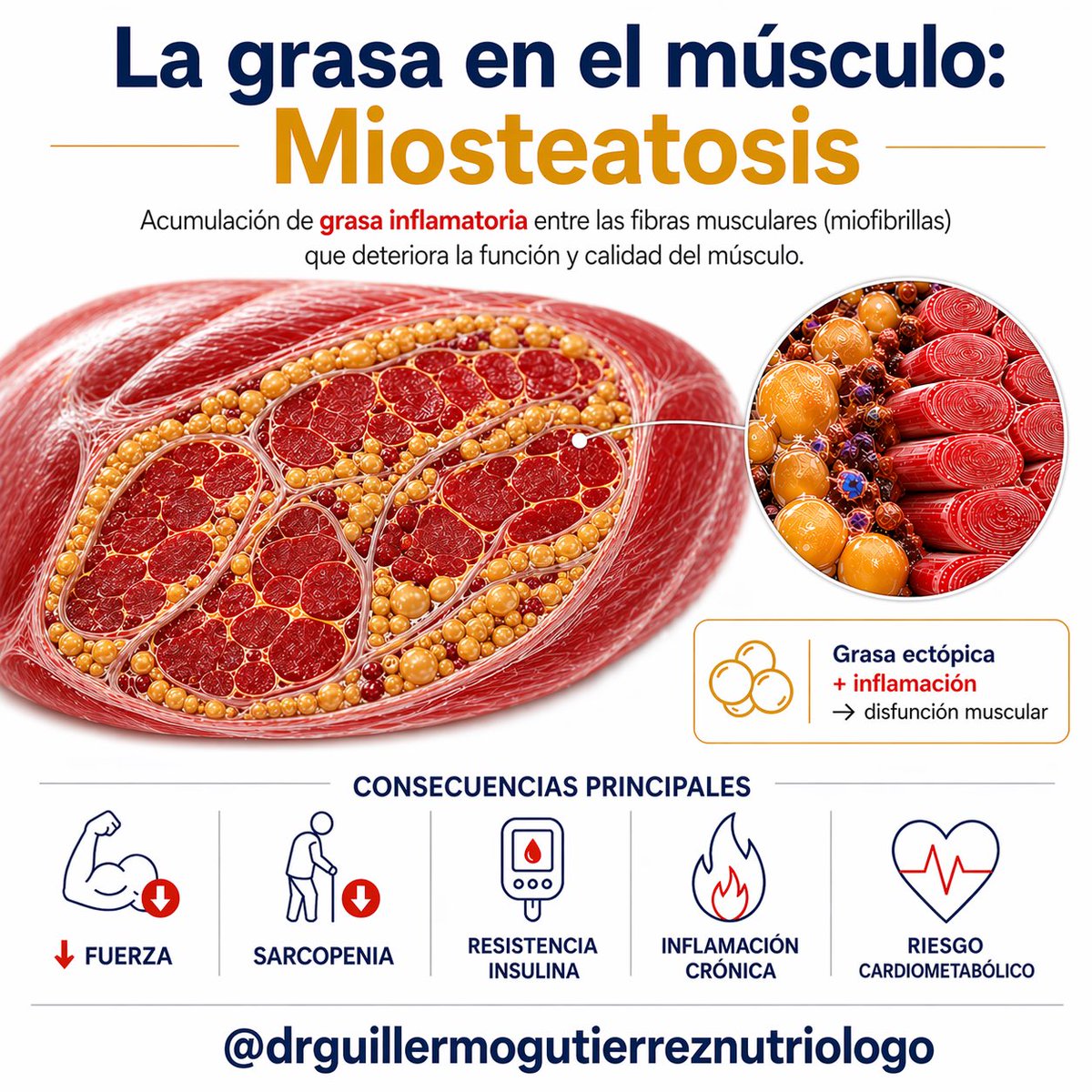 El músculo es clave en el  equilibrio metabólico y envejecimiento saludable.

El aumento de grasa corporal, en especial grasa visceral abdominal, produce inflamación en las fibras musculares y favorece su deterioro. 

La salud muscular se basa en la calidad y no solo cantidad.