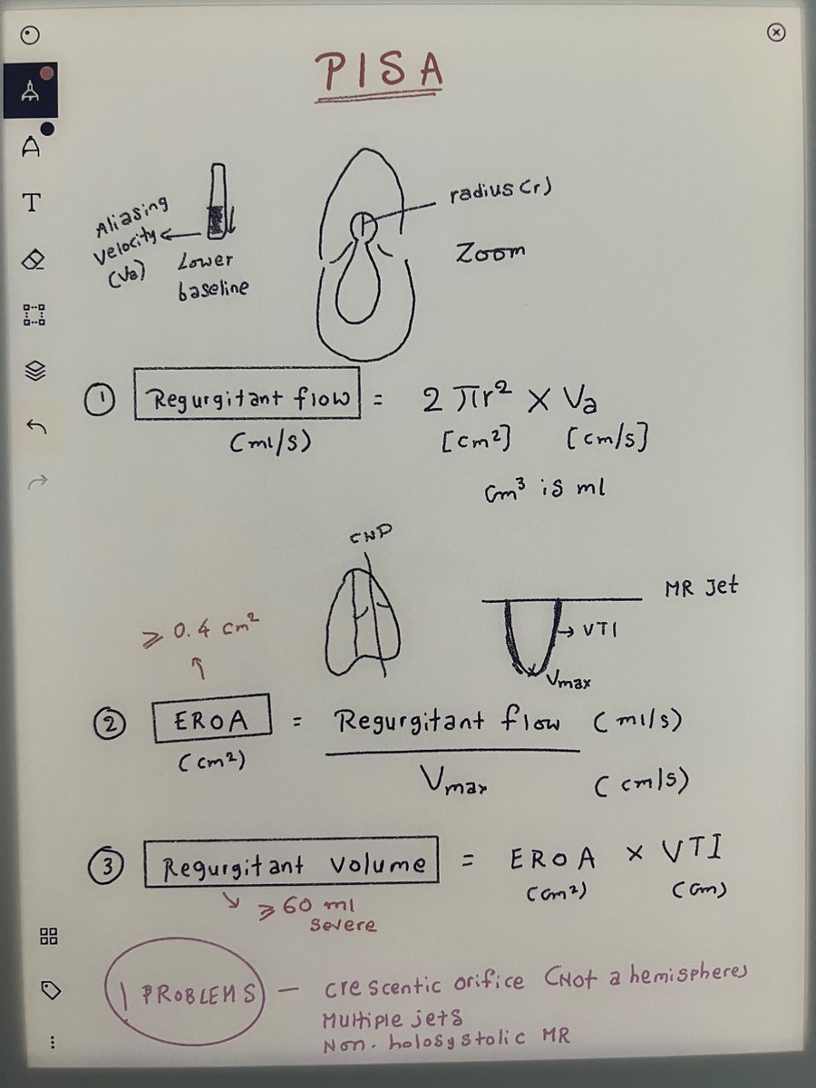 NephroP's tweet image. Open-evidence era, unlimited AI at our fingertips…
and still the attending’s quick, half-legible PISA sketch quietly wins the room…
especially when it’s a nephrologist explaining MR 😄
#Nephpearls #FOAMed #POCUS