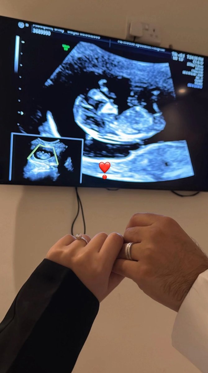 شُعور فائض tweet media