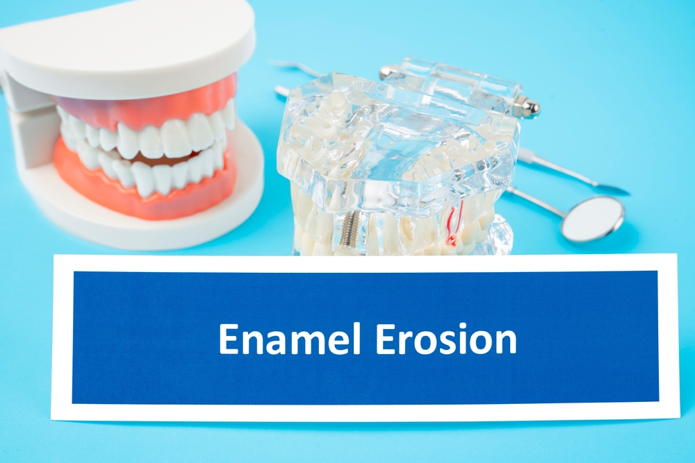 smileleaguedent's tweet image. Your smile depends on strong enamel, once it’s gone, it doesn’t grow back. This guide explains what wears it down and how to protect it every day. 💧🦷bit.ly/48x1oDw #DentalHealth #EnamelErosion #OralCare #HealthySmile #PreventiveDentistry