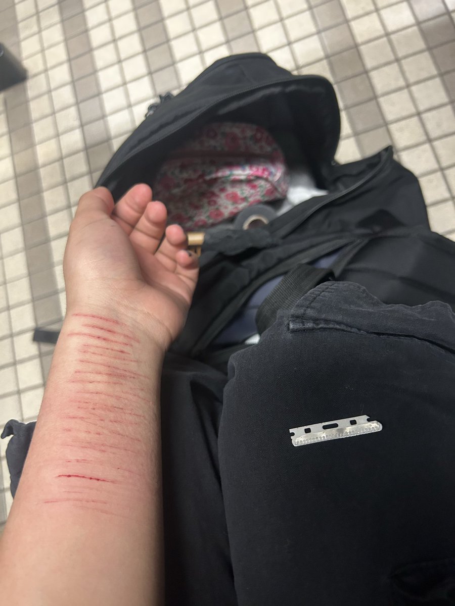 scarrrfac3's tweet photo. feels so good in the school bathroom😩 #shtwt #sh #blade https://t.co/SHiQIT5mKS