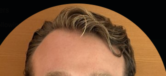 NightNight tweet media