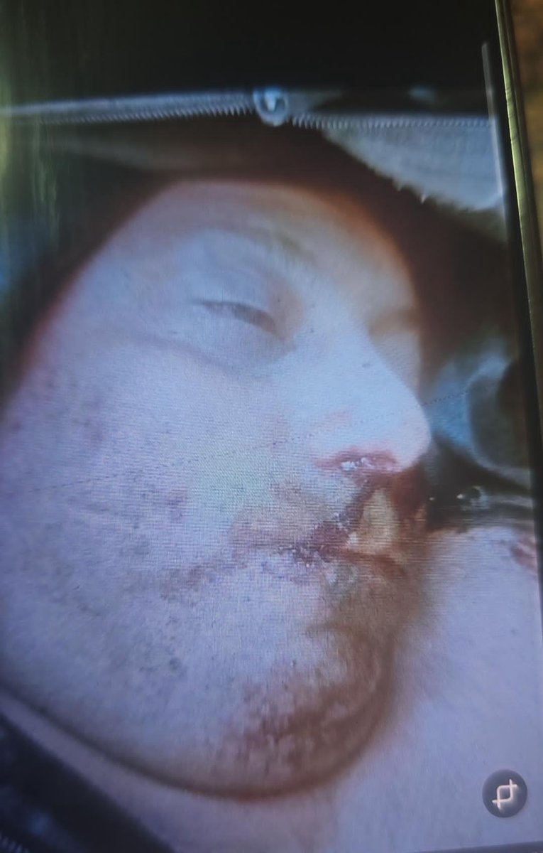 Armita Abbasi 🇮🇷 tweet media