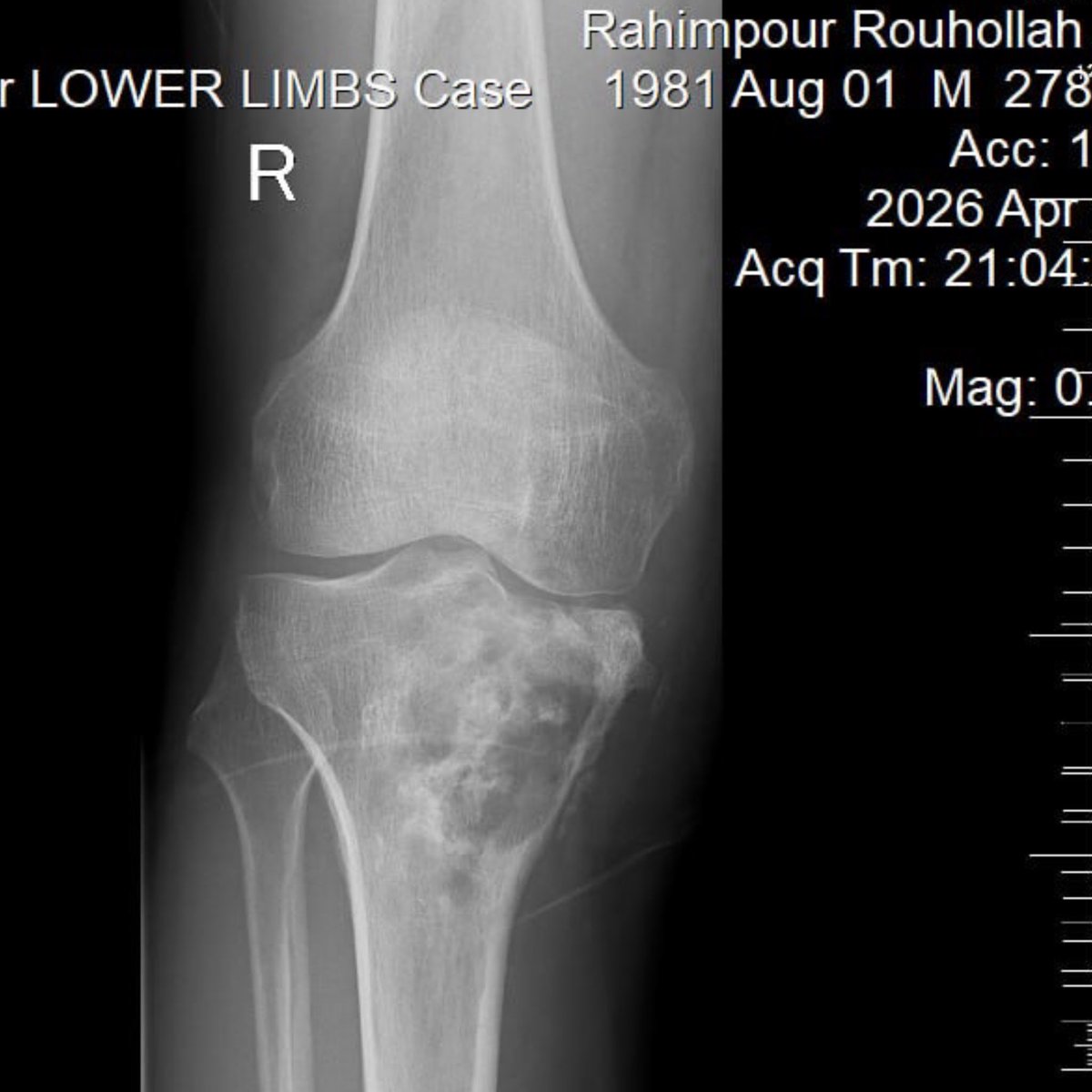 Rouhollah Rahimpour tweet media