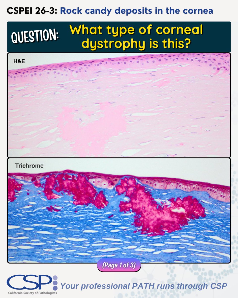 Ca Pathologists tweet media