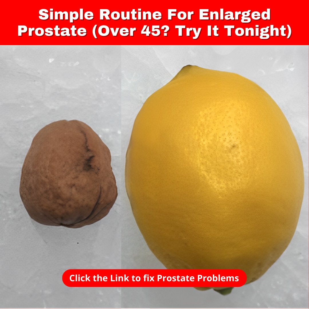 trade_2022's tweet image. #prostate #prostatecancer #cancer #urology
#menshealth #health #prostatehealth #kidney
#urologia #prostata #men #endourology #over
Space Secrets: Astronauts' Prostate Wisdom.
See how to fix👇prostate issues in the video.
👉 f.mtr.cool/tzouraqgrn 👈