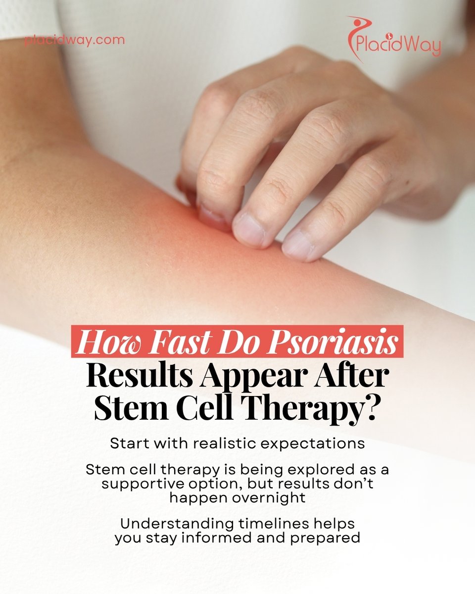 PlacidWay's tweet image. How fast can psoriasis improve with stem cell therapy? Patients are exploring treatment in Puerto Vallarta for personalized care and visible results timelines.

Full guide: placidway.com/answer-detail/…

#Psoriasis #StemCellTherapy #SkinHealth #MedicalTourism #PuertoVallarta