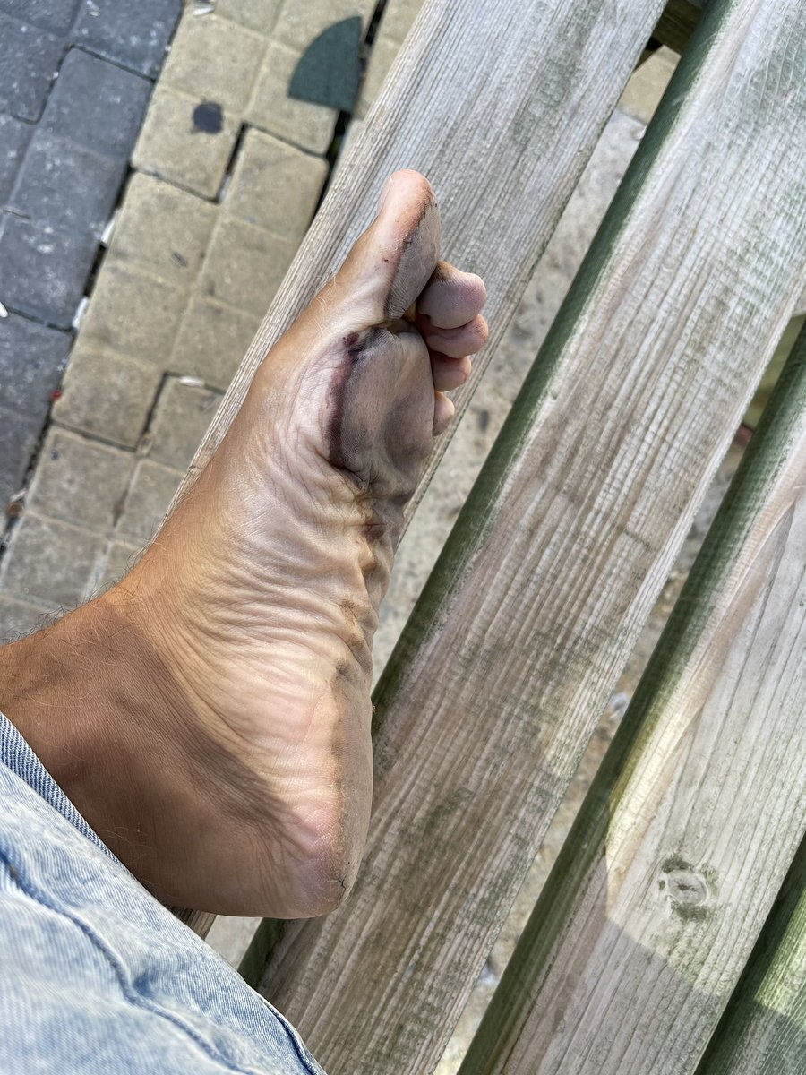 My always bare feet in the city! 24/7!