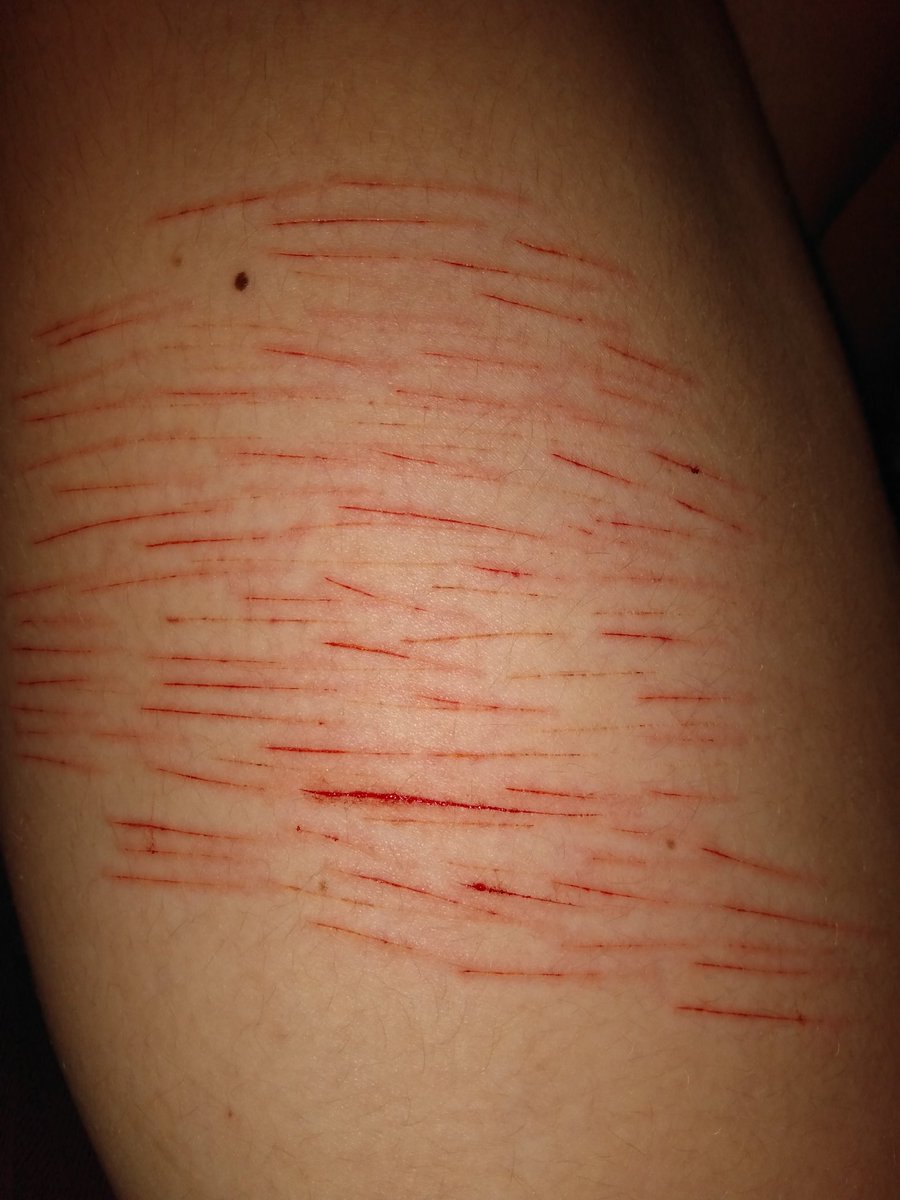 ⪼∘「ᴢᴜᴋᴀ」ᴏғ sʜᴛᴡᴛ tweet media