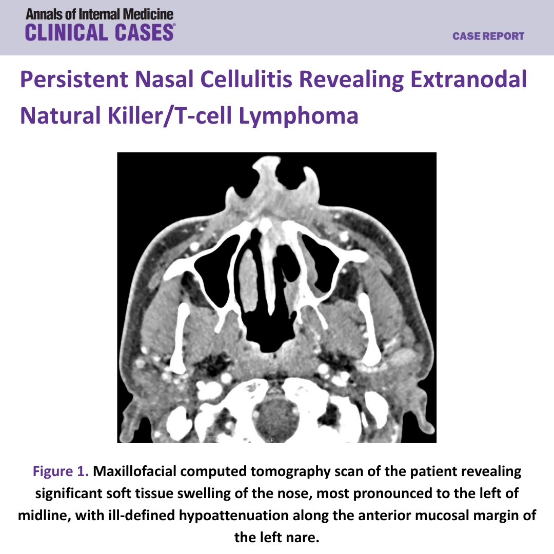 Annals of Internal Medicine: Clinical Cases tweet media