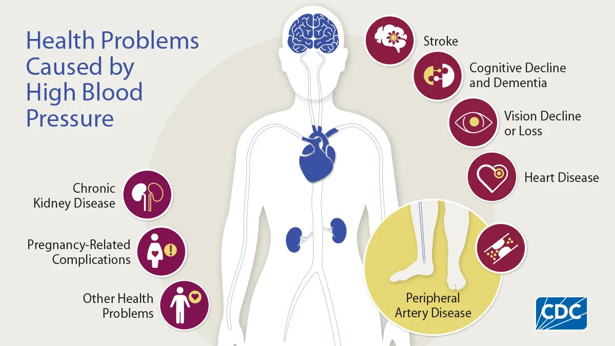 rushalzheimers's tweet image. High #BloodPressure can damage your health in many ways. The good news is that, in most cases, you can manage your blood pressure to lower your risk for serious health problems. 

Read more about managing #Hypertension at cdc.gov/high-blood-pre…

#HighBloodPressureEducationMonth