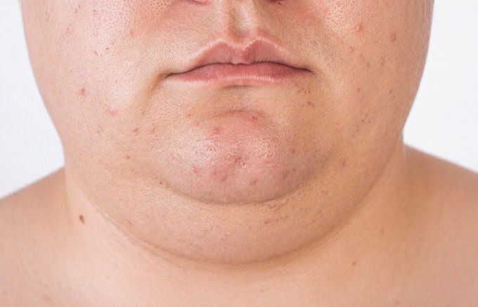 Yosuep Esteban tweet media