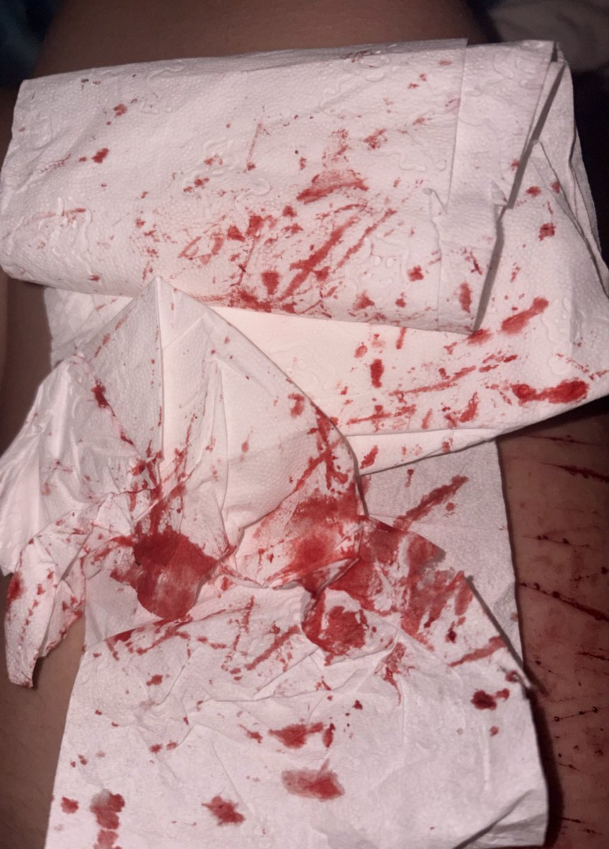 iris (˶˃ ᵕ ˂˶) ⋆. 𐙚 ˚ tweet media