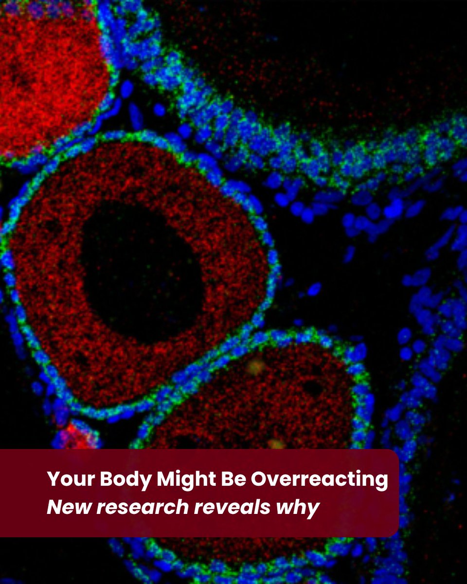 AmFriendsHU's tweet photo. New research from @HebrewU reveals that it’s not just DNA damage driving severe genetic disorders, it’s the body’s inflammatory response to it.

By dialing down an overactive immune sensor (cGAS), researchers restored tissue function across multiple systems.

A promising new direction for treating degenerative diseases. 🔬

Read more about this groundbreaking research: https://t.co/cwQzotV39E

#MedicalResearch #Aging #Immunology