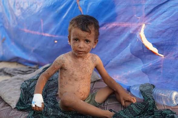 Aseel Gaza🇵🇸 tweet media