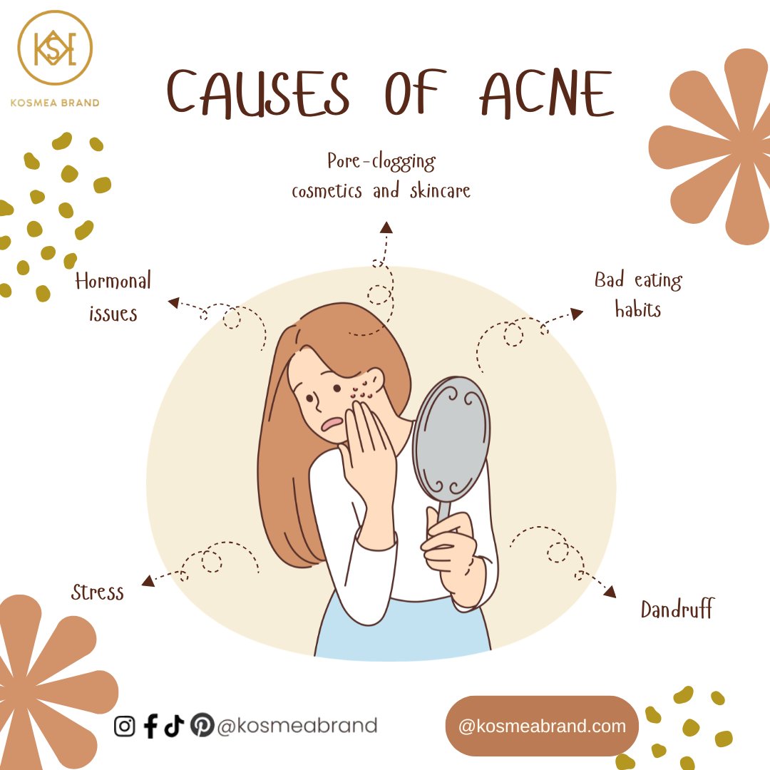 kosmeabrand's tweet image. Some common causes of acne #acne #acnetreatment #skincaretips #skincare101