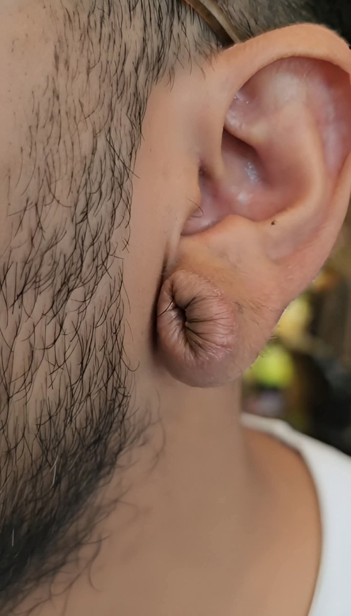 Renato Gaúcho Insider tweet media