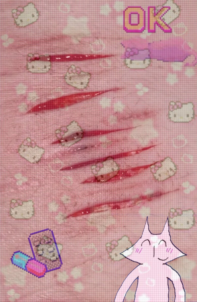 ✰Anemixoxo✰ tweet media