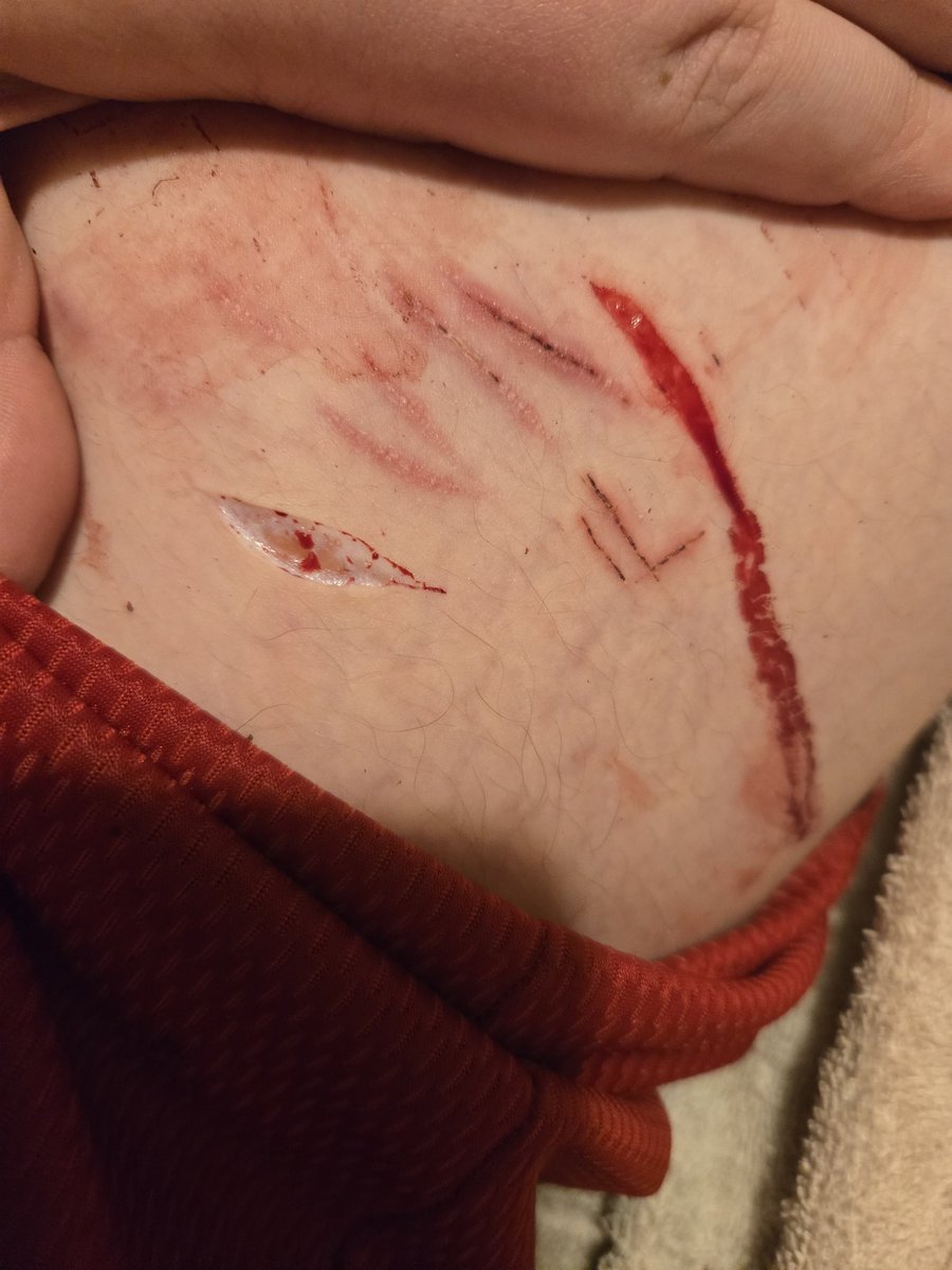 flimflam44's tweet photo. I keep getting the most babiest of beans and its driving me nuts. These hurt so much worse than just straight beans idk why but augghrbsjfbebdf they sting 😭😭 https://t.co/Q5yc7uC7pL