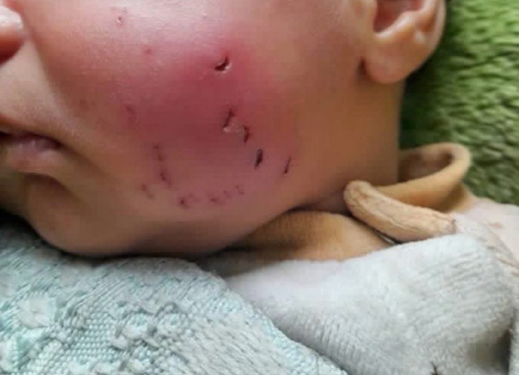 Lara in GAZA 📍 tweet media