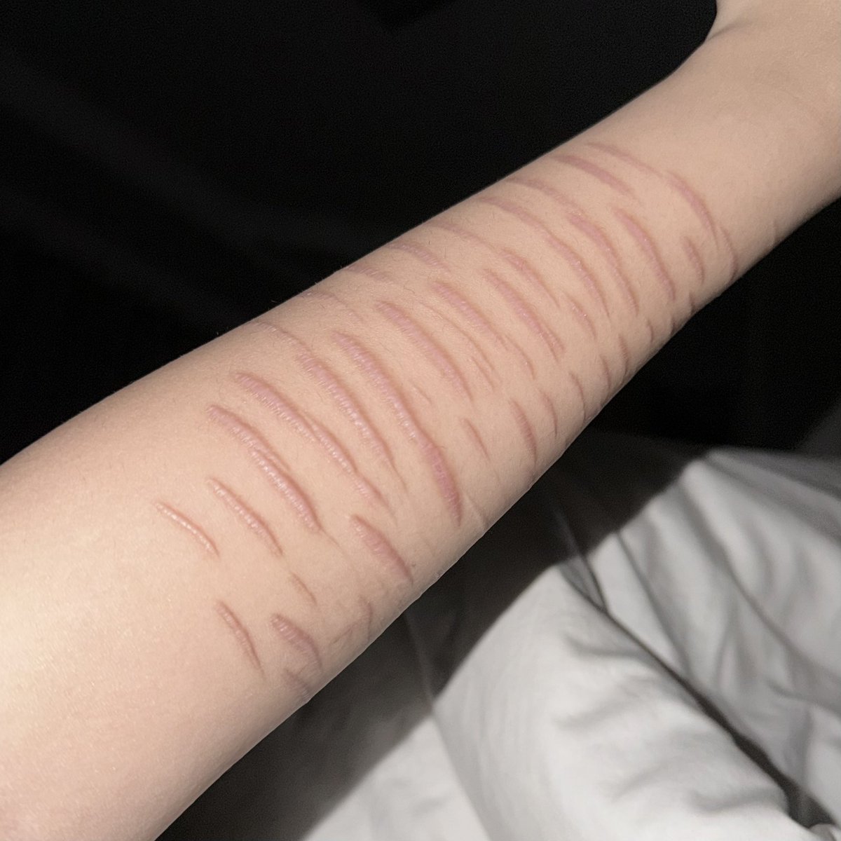 水母体（戒割中 tweet media