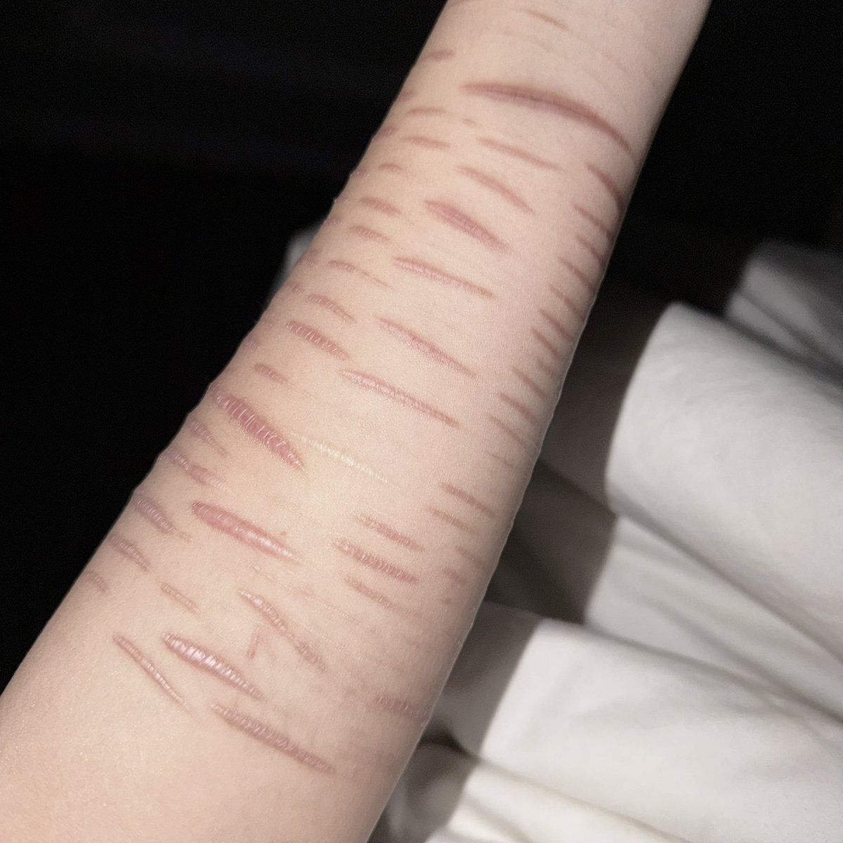 水母体（戒割中 tweet media