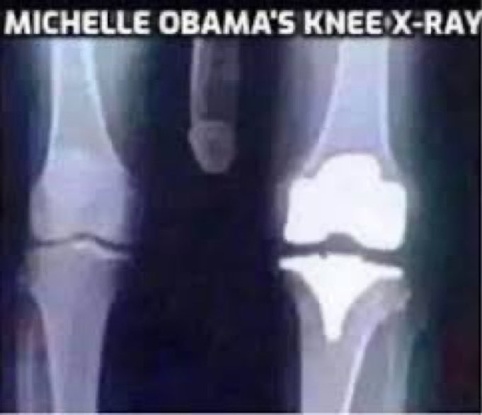 Medevil_Mindset's tweet photo. @JDunlap1974 Knee problems. https://t.co/Vg1sq3fdW8