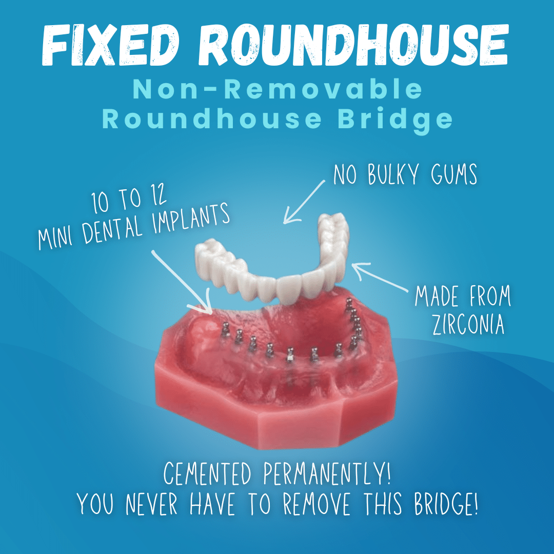 johnhopkins_dds's tweet photo. Whether you are missing a single tooth, multiple teeth, or all of your teeth, Dr. Hopkins has solutions for you with mini dental implants. #gulfport #implant #dentist https://t.co/YOTfeUZeF0 https://t.co/JcX6BGTXVF
