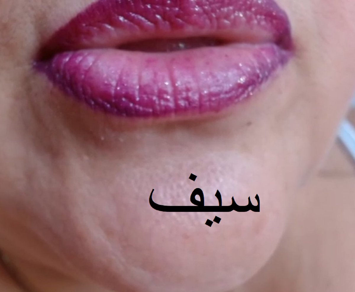 سيف الباسم tweet media