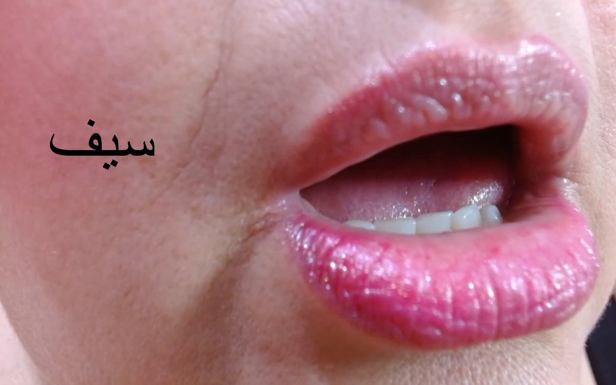 سيف الباسم tweet media