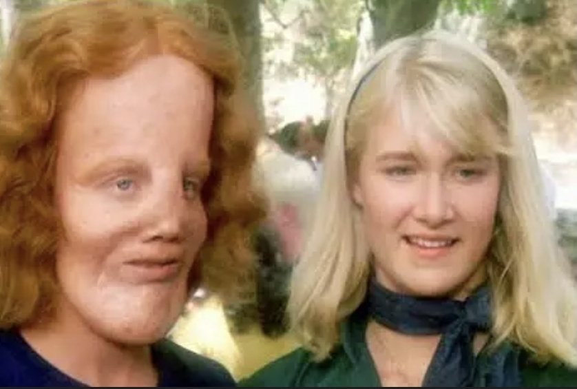 dramatic_one's tweet image. Laura Dern 
#Foxes
#Mask
#BlueVelvet

@corbydavidson