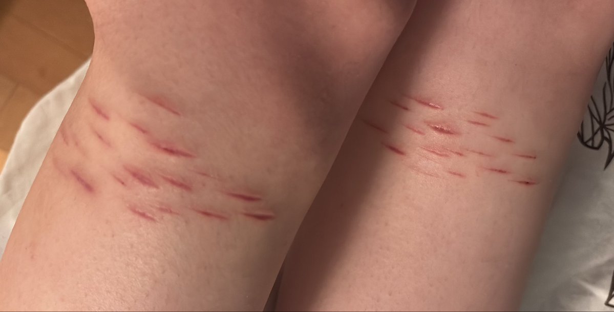 mika😛 | shtwt tweet media