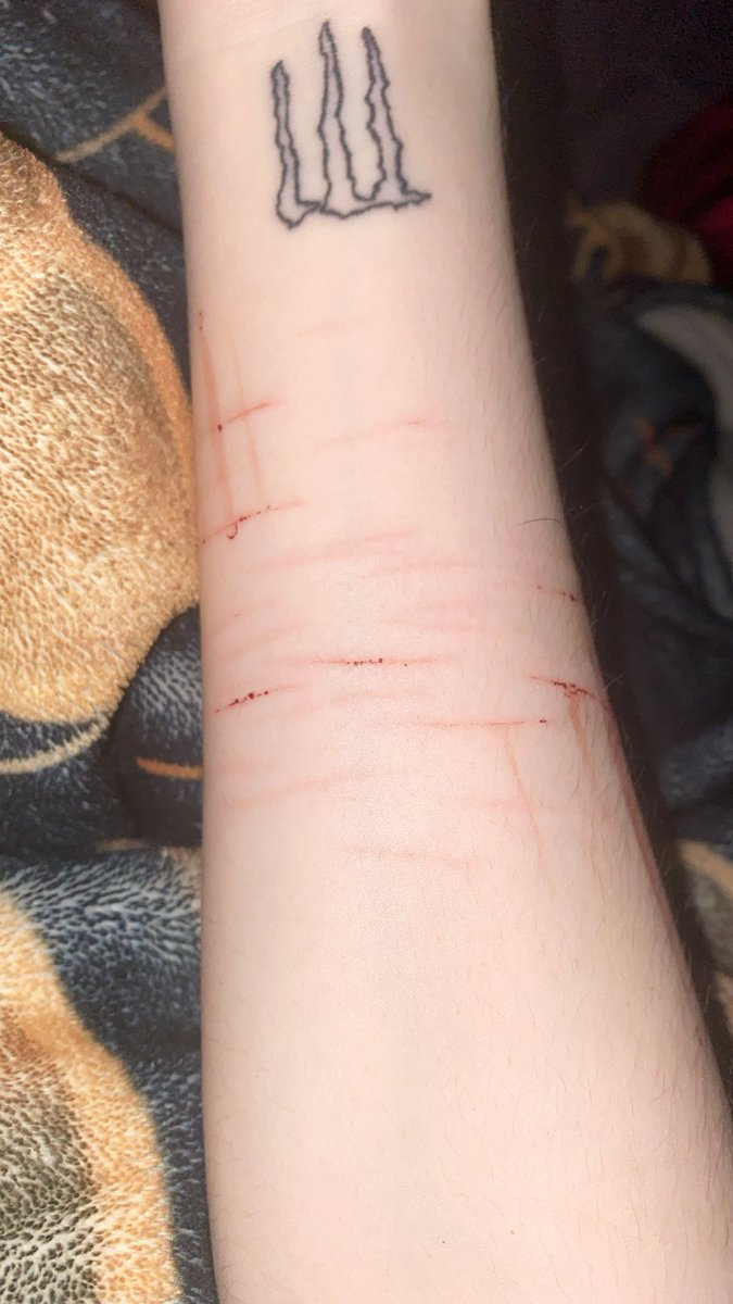 _diviniity's tweet photo. fuck that, small relapse 

#sh #shtwt #catscratches https://t.co/gEijtY4Rko