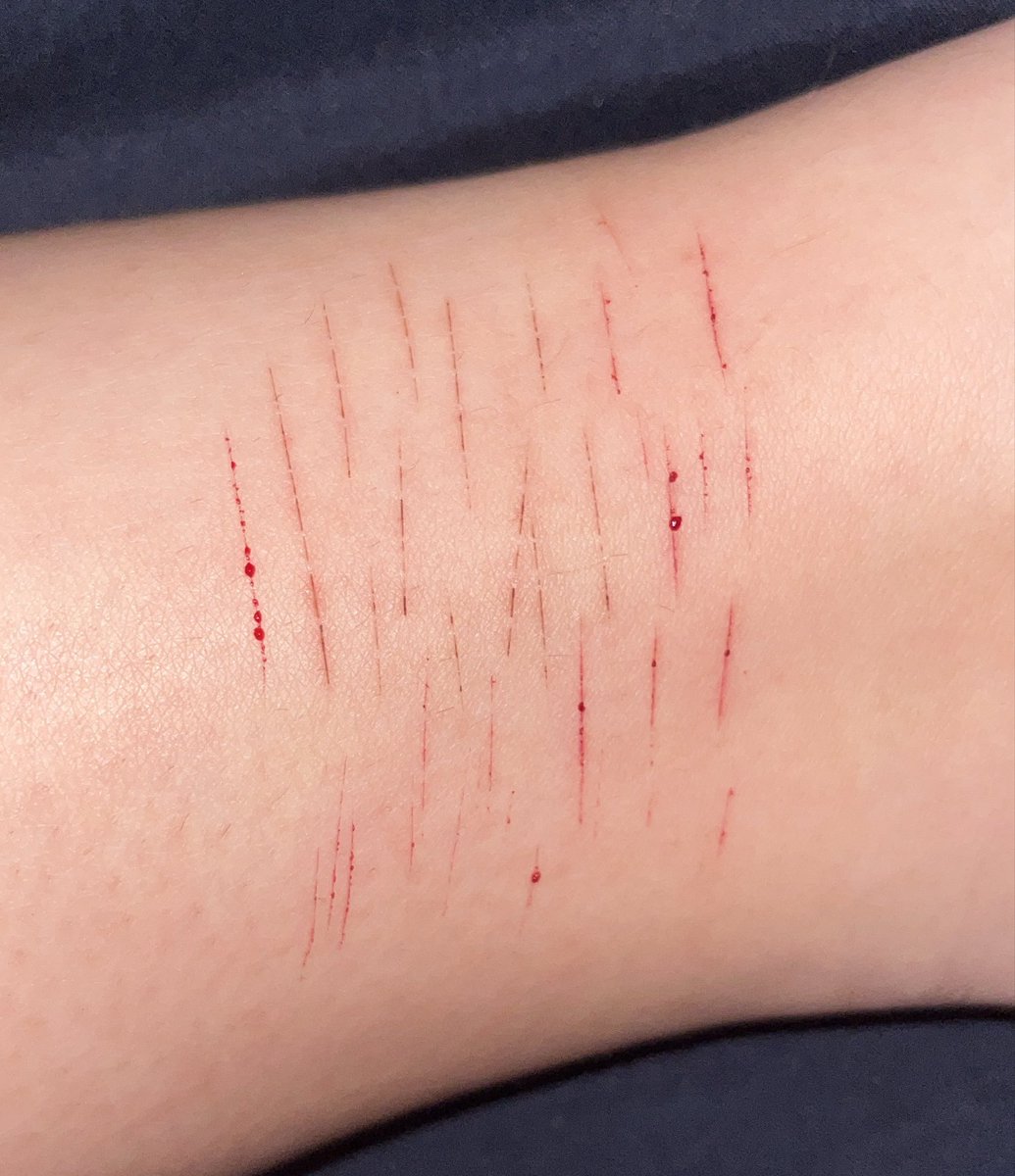 ✦◞˚𝚝𝚜𝚞𝚔𝚔𝚒 𝚘𝚏 𝚜𝚑𝚝𝚠𝚝 tweet media