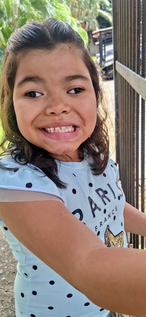 mariani87784922's tweet photo. Soy Mariana una niña con distintos diagnósticos 
Hidrocefalias,pubertad precoz,epilepsia, hemiparesia izq y extrabismo 
Requiero la colaboración y ayuda para cubrir tratamientos ,terapia y operación de ojos

No cuento con los recursos y quiero tener una vida normal
Gofu en mi bio https://t.co/Hn6x0Hl6XK