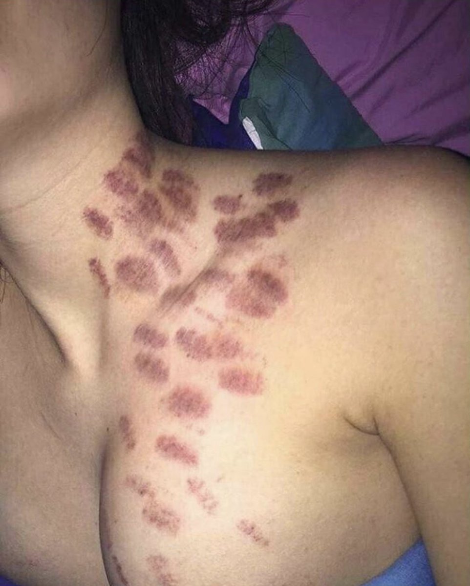 ⭕ مانو ⭕ tweet media