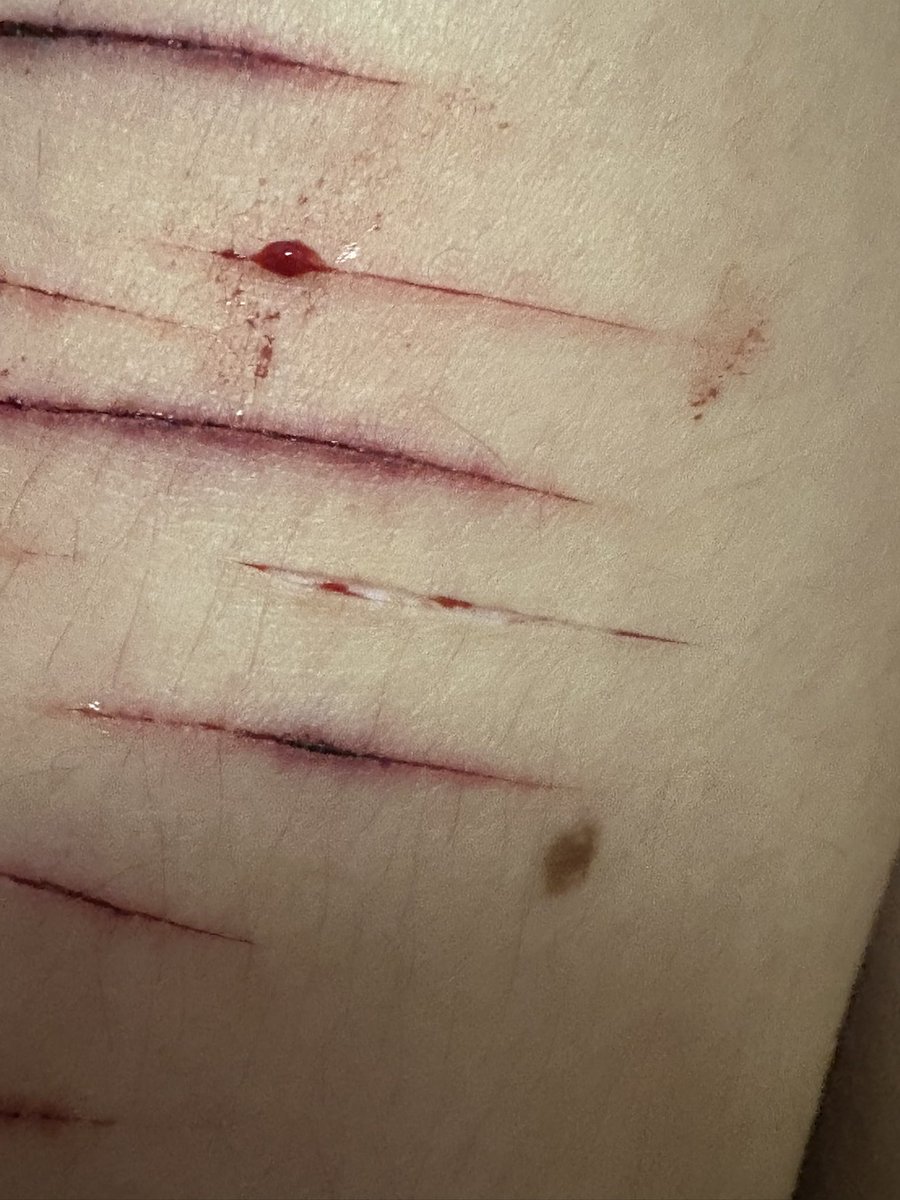 bri | shtwt .✦ ݁˖ tweet media