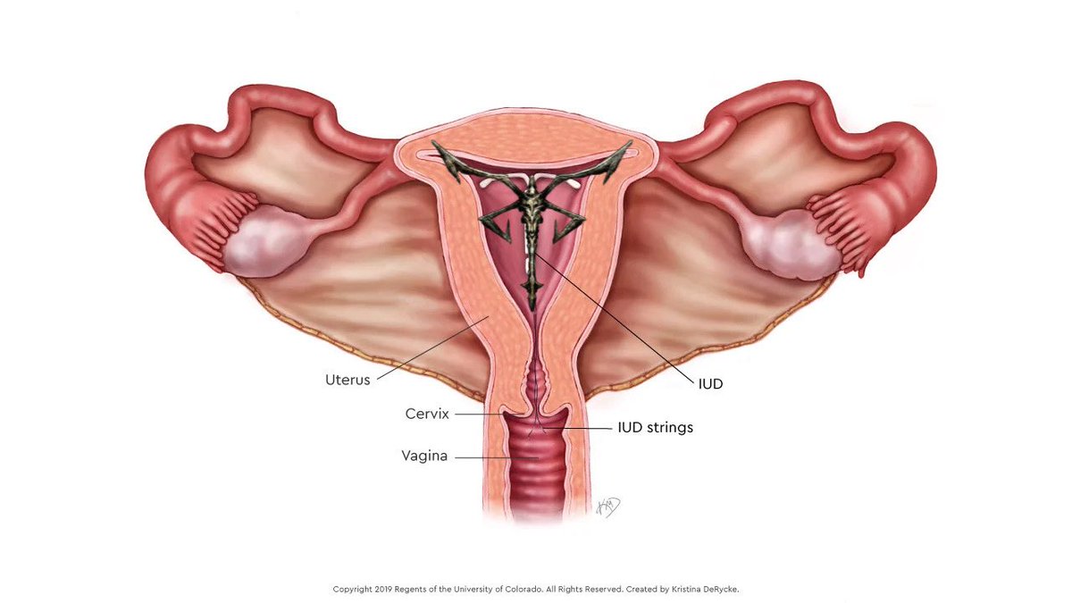 Tony Joker tweet media