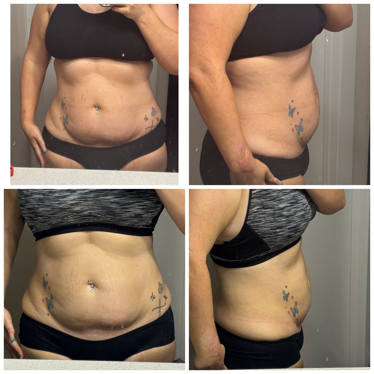 StrosSteph's tweet photo. Glow up Day 36 of 100 ✨
One week difference and I’m seeing the work show. Walking, resistance bands, consistency. Small changes become big ones. July 7, I’m coming. 💪🤍 #GlowUp #FitnessJourney #ProgressPic https://t.co/MaYi4s90cm