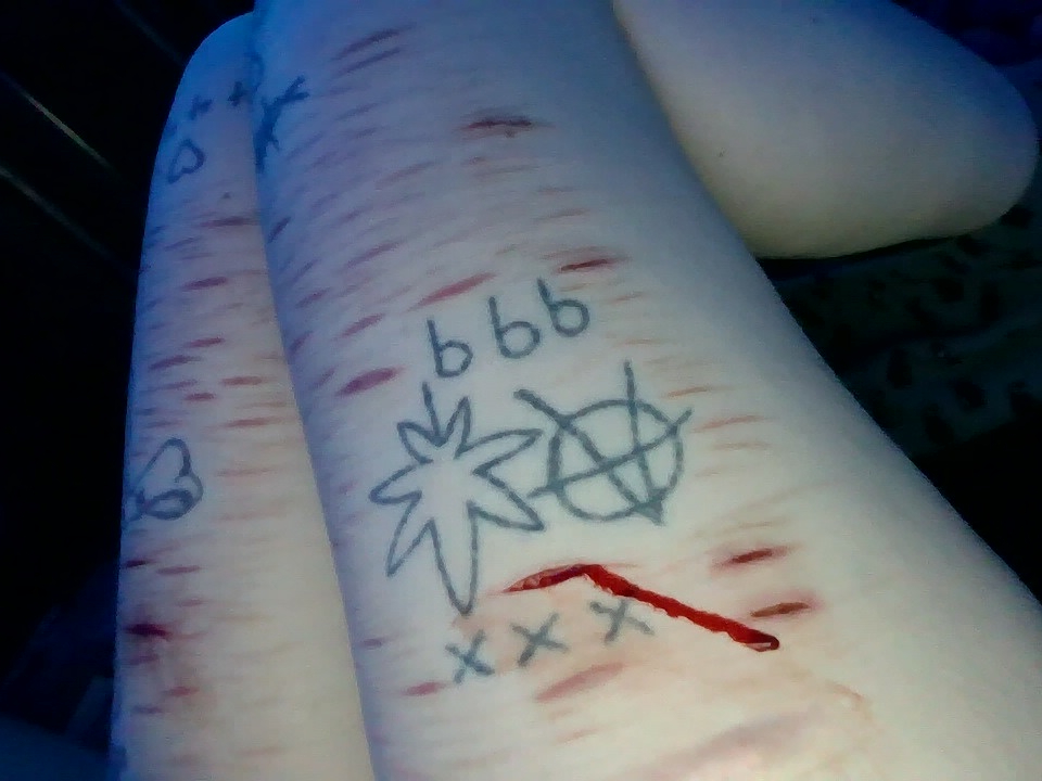 necrokitty420's tweet photo. fake blood fake cuts #slitwt #cutspo #beanspo #styrospo #styrotwt #shedtwt #shtwt #fakebody #seshy #drugtwt #bpdtwt #multiswipe https://t.co/6iADin64QM